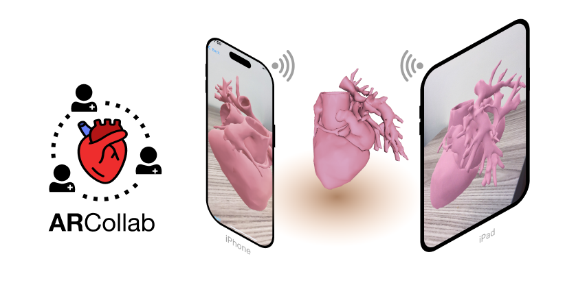 ARCollab: Collaborative Cardiovascular Surgical Planning in Mobile AR