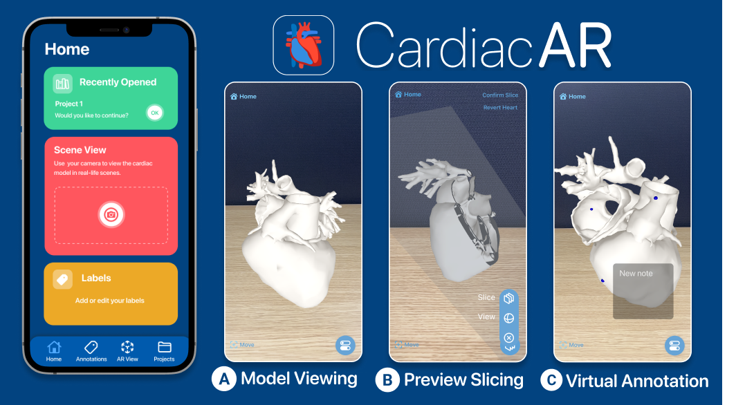 CardiacAR Evaluation: Evaluating Cardiovascular Surgical Planning in Mobile Augmented Reality
